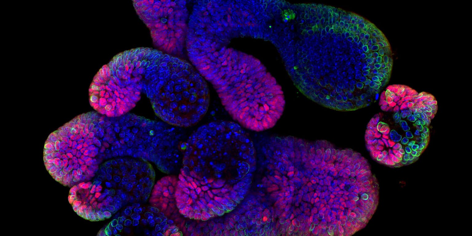 Een close-up van cellen uit de darm.
