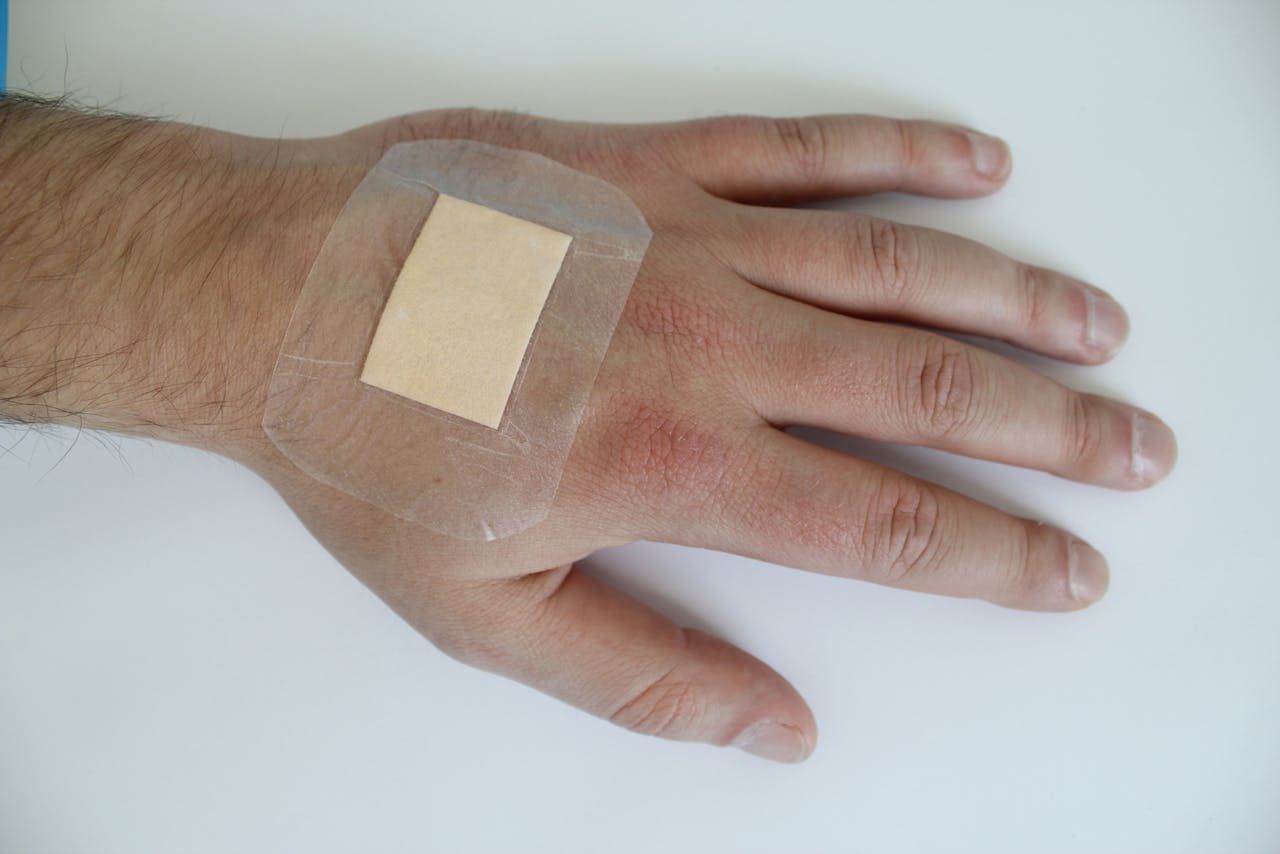 Een gewone pleister dekt de wond af en houdt bacteriën tegen.