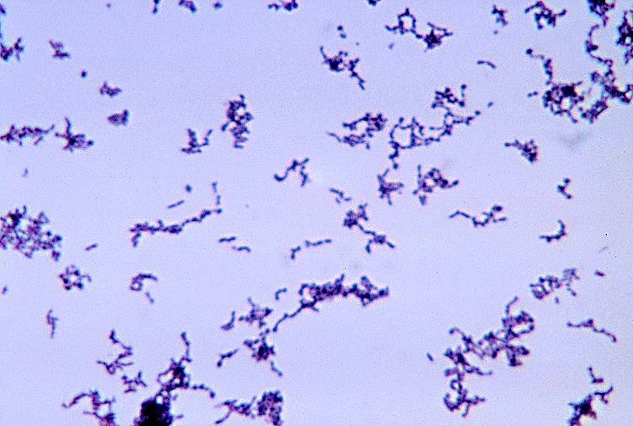 Propionibacterium acnes op de afbeelding als groep weergegeven. De afbeelding is paars.