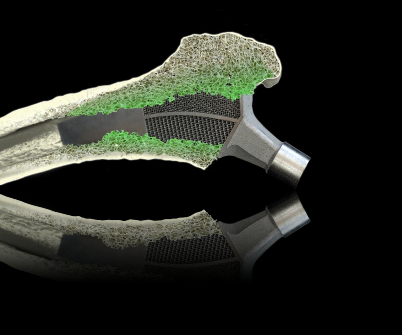 Het materiaal voor een nieuw heupimplantaat werd met een 3D-printer gemaakt.