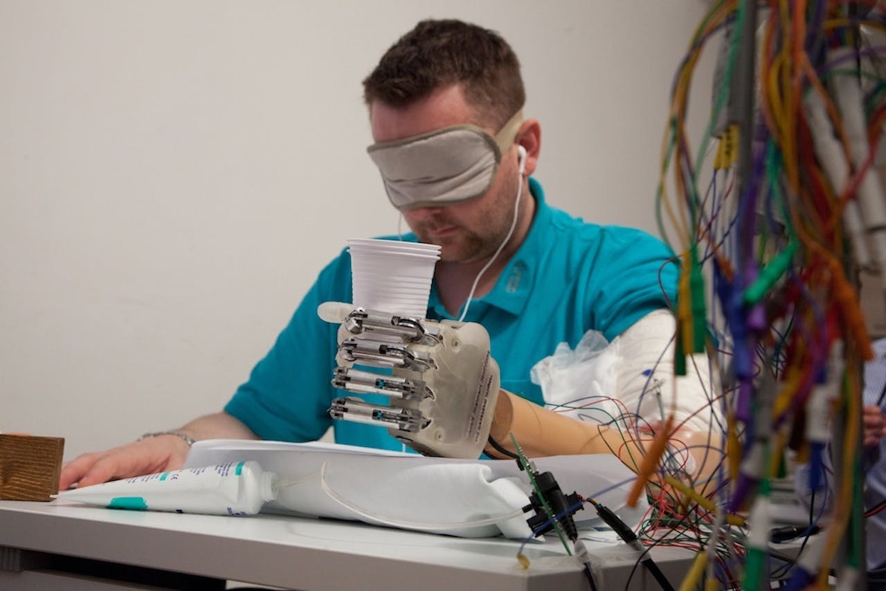 Door deze handprothese is het voor de patiënt mogelijk een zacht object blind vast te pakken zonder het fijn te knijpen.