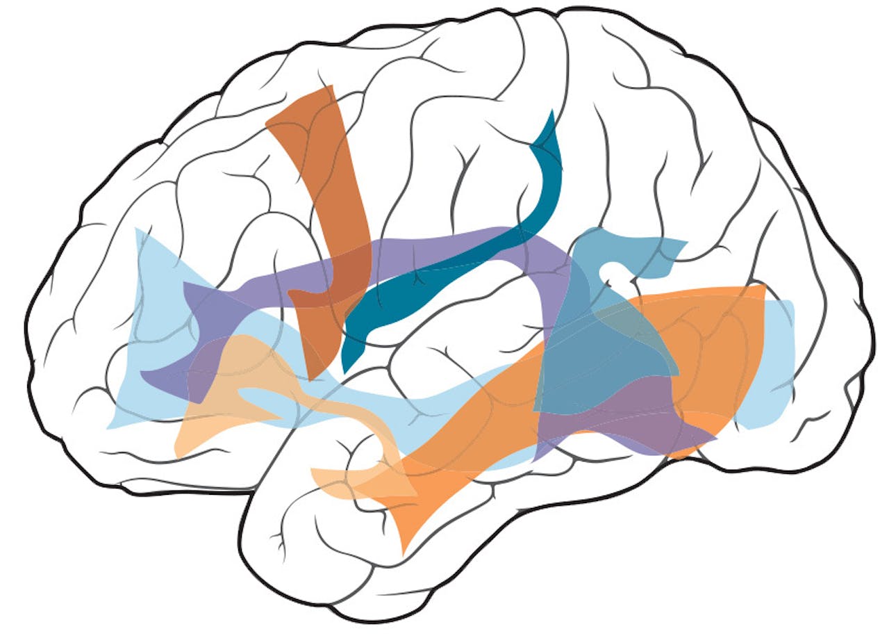 Een tekening van de hersenen met daarop enkele gekleurde vlakken.