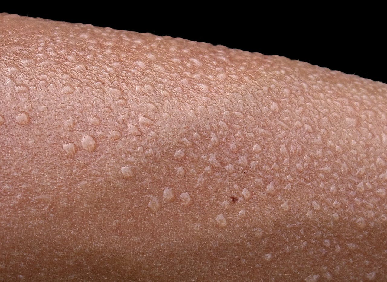 Een close-up van iemands arm met transpiratiedruppels.