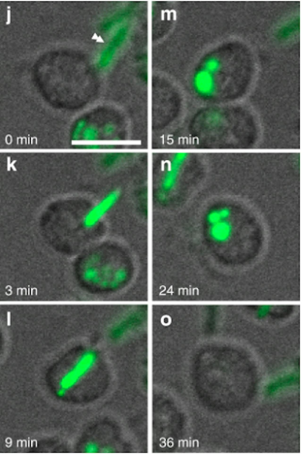 Microscopische opname van de nieuw ontdekte bacterie ‘Candidatus Uab amorphum’ die een complete cel (groen) opneemt.