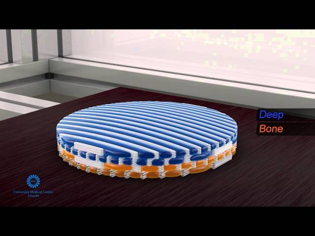 Hier een still uit een animatie over de bioprinter. Het implantaat heeft de vorm van het gat in de knie en bevat zowel bot als kraakbeen.