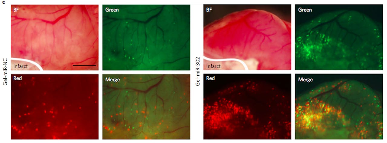Hartweefsel na injectie van de hydrogel met miRNA in het geïnfarcteerde hart van een muis. Het verschil tussen de foto’s links en rechts is de binding van miRNA aan cholesterol (links niet, rechts wel). De lichtgevende puntjes zijn nieuwe hartspiercellen. Rechts zijn er beduidend meer te zien; binding aan cholesterol helpt dus aantoonbaar om miRNA in de voorlopercellen te krijgen, waardoor deze actief worden en zich gaan delen.
