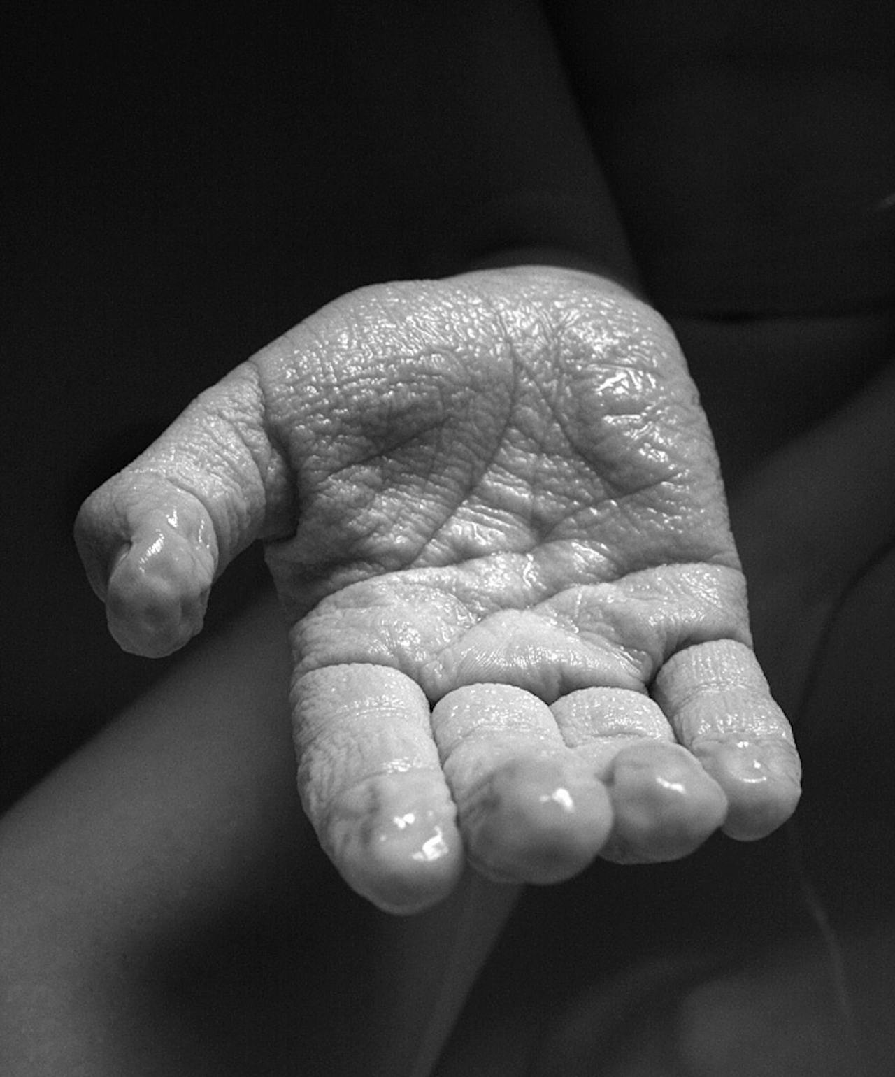 Een zwart-wit foto van een hand met rimpels.