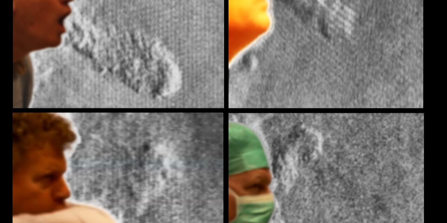 Een fotocompilatie van de luchtverplaatsing. Ruud Verdaasdonk hoest en niest in de compilatie in de open lucht, in de elleboog en met een mondkapje.