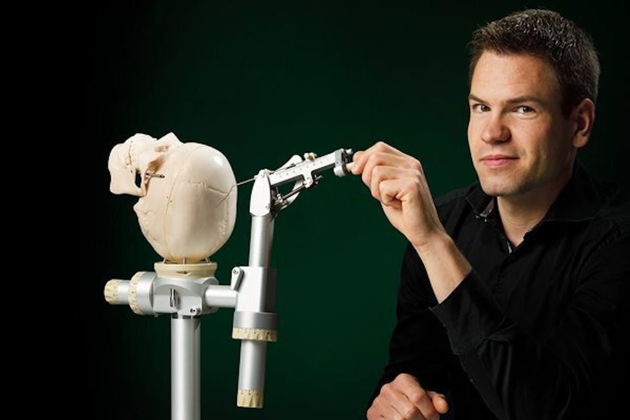 Marc Janssens met het nieuwe instrument voor hersenchirurgie. Op de achterzijde van de schedel is de referentieschijf vastgeschroefd (zandkleurig). Het instrument is vervolgens gekoppeld aan deze schijf. De knop die Janssens vast heeft, bedient de inbrengbeweging van de elektroden.