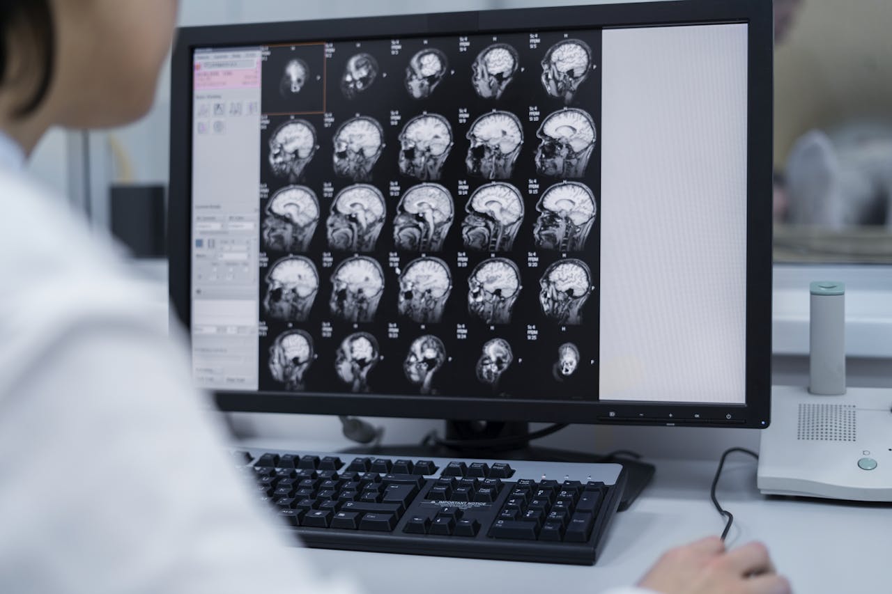 Een dokter kijkt op een scan naar hersenen, op de achtergrond is nog net een mri-scanner te zien