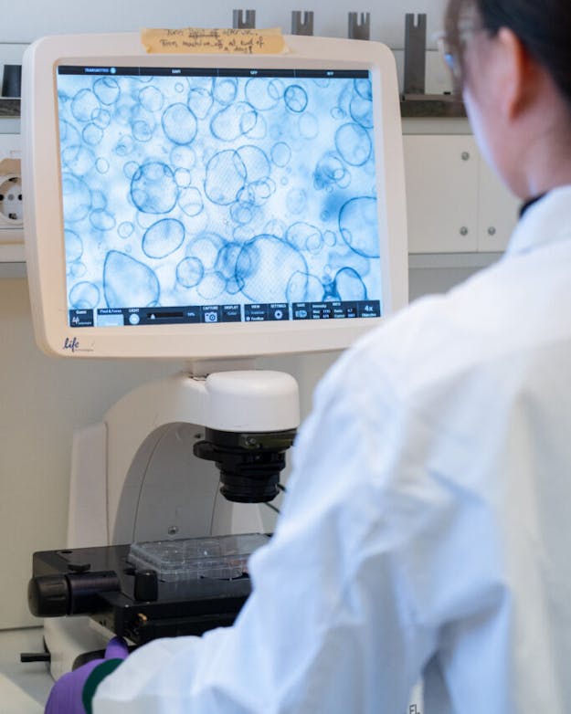 Het screenen van organoïden met de microscoop. Onderzoeker in het lab kijkt naar cellen op een beeldscherm.