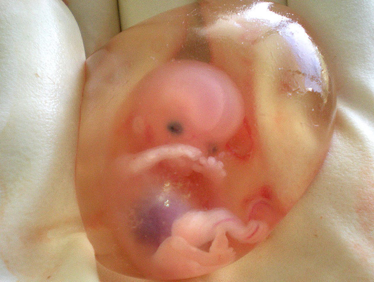 Een foetus van 10 weken.