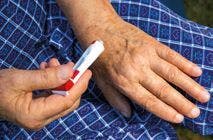 Een persoon heeft een tube creme vast en zit met de tube bij de hand.