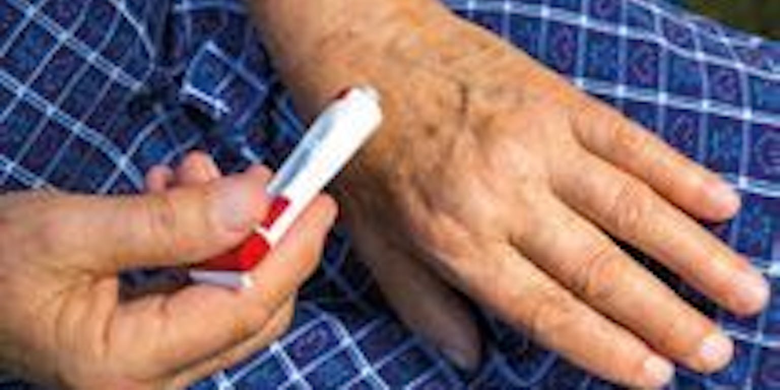 Een persoon heeft een tube creme vast en zit met de tube bij de hand.