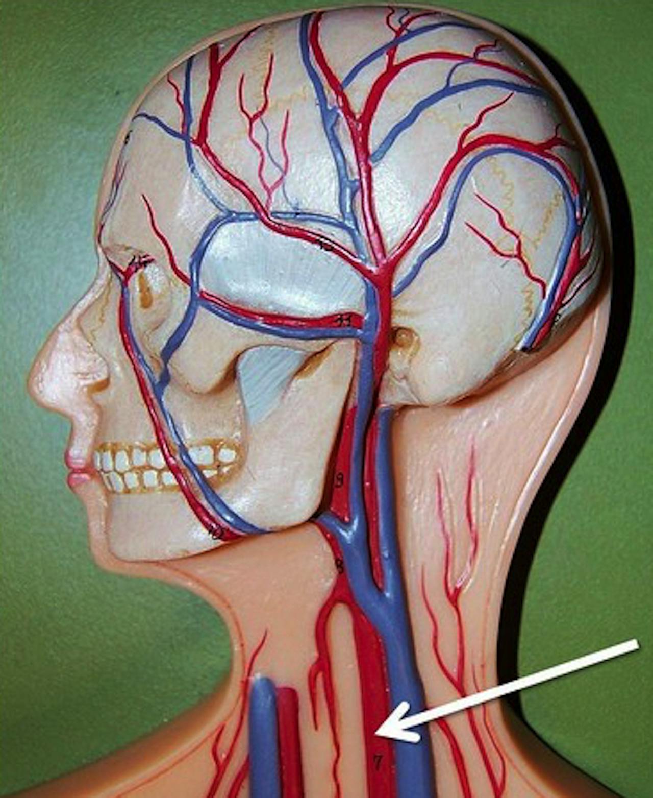 Сосуды на лбу. Сонная артерия и яремная Вена. Внутренняя яремная Вена и Сонная артерия.
