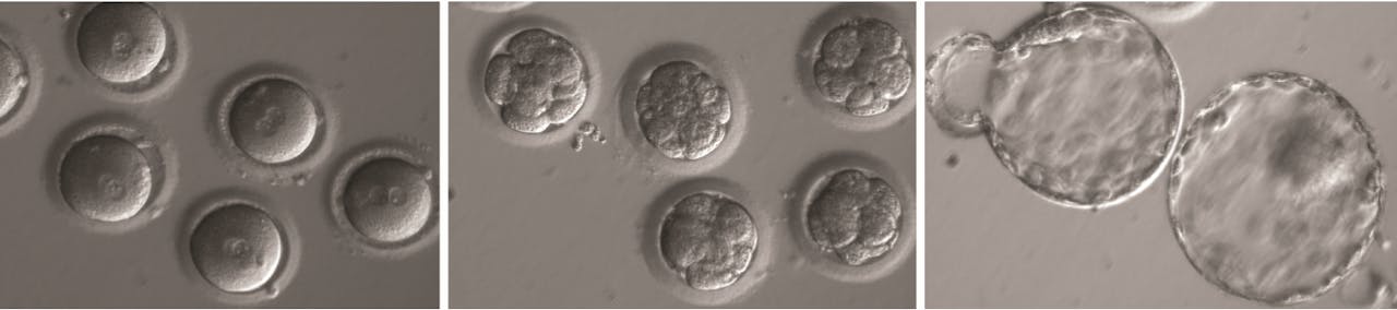 Links: de zojuist bevruchte en met Crispr-Cas behandelde eicellen, midden: het stadium met acht cellen, rechts: het blastocyst-stadium, als het embryo al een klompje van diverse types cellen is geworden.