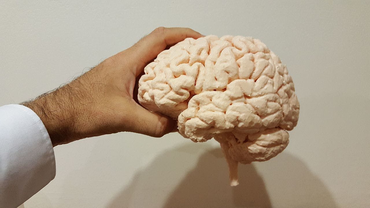 Een 3D-print van onze hersenen.