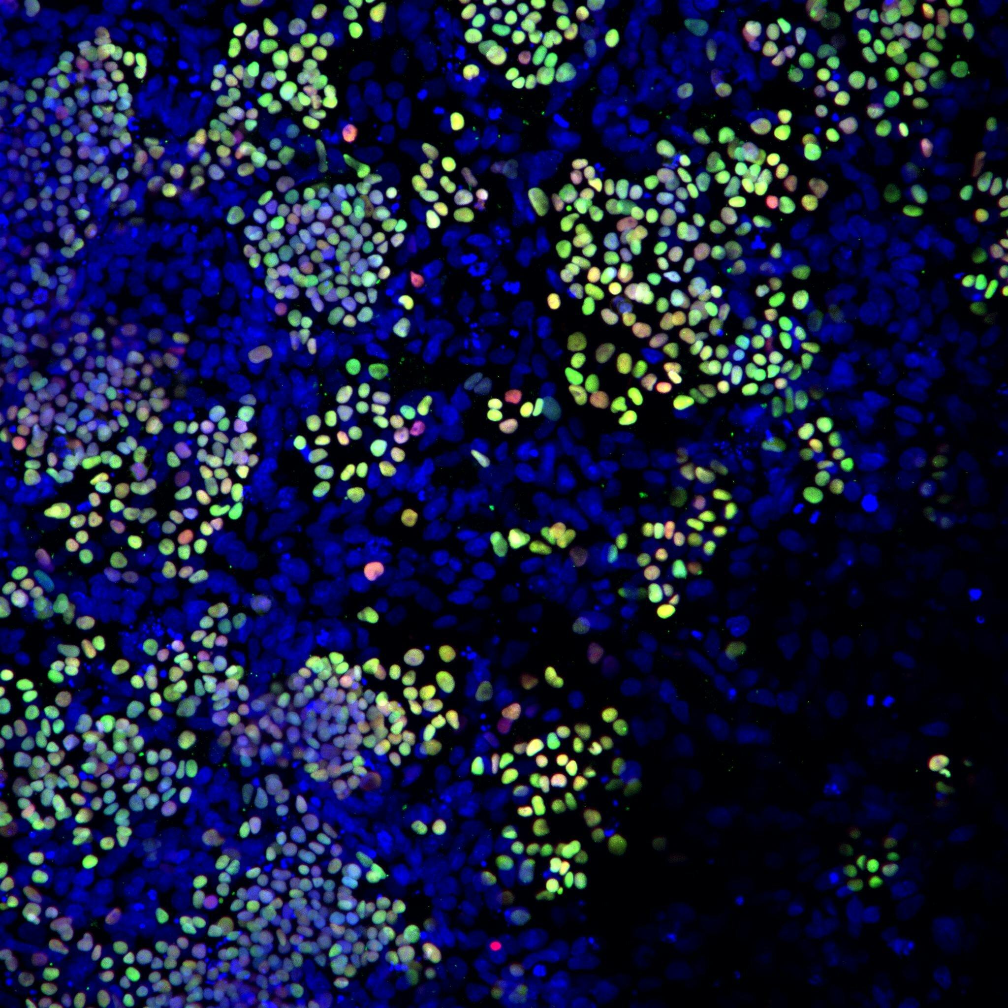 Human primordial germ cell like cells