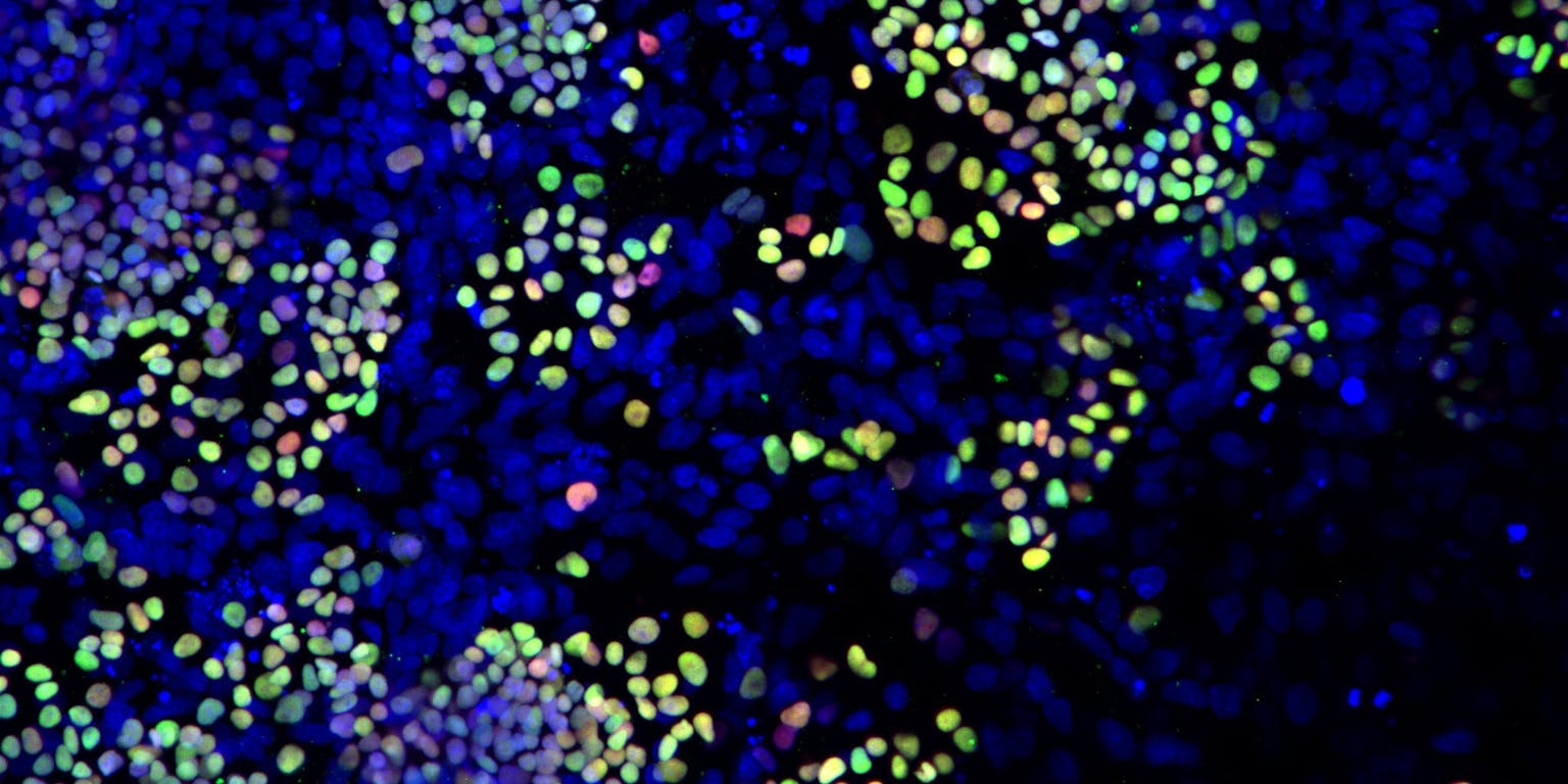 Human primordial germ cell like cells