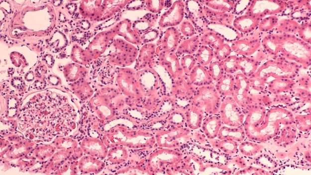Microscopische foto van nierweefsel, roze gekleurd