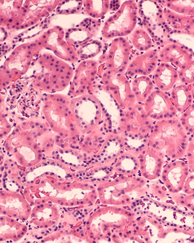 Nierweefsel Microscopische foto van nierweefsel, roze gekleurd