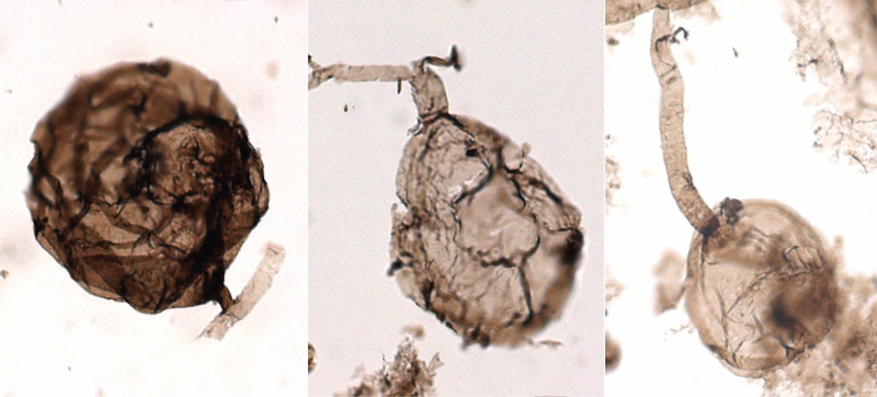 Drie microscoopfoto’s van de Ourasphaira giraldae. De bolletjes zijn sporen, van ongeveer 0.05 mm, de buisjes zijn schimmeldraden.