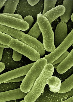 Close-up van e-coli bacteriën.