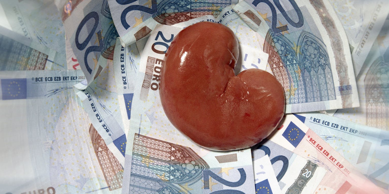 Een nier omringt door briefgeld.
