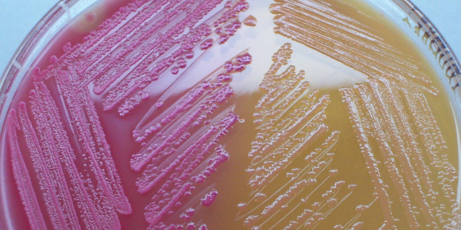 Een close-up van micro organismen met een roze en gele kleur.