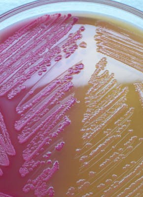Een close-up van micro organismen met een roze en gele kleur.