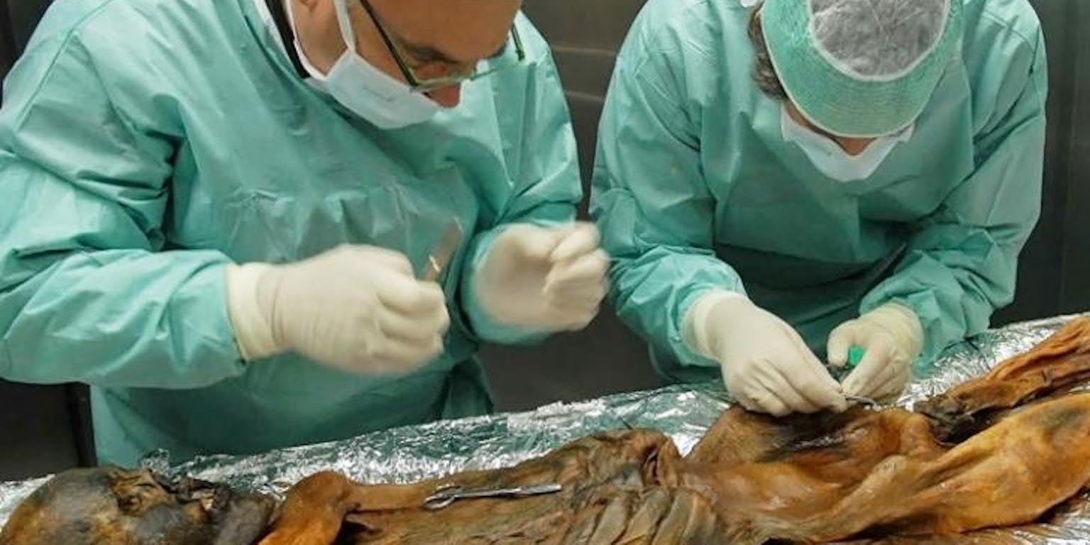 Twee chirurgen werken op een autopsietafel aan Ötzi.