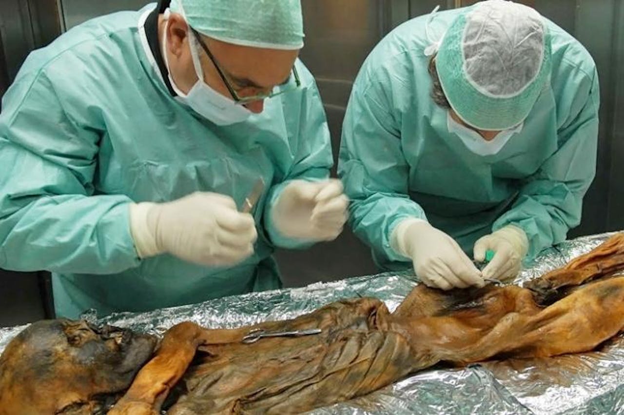 Twee chirurgen werken op een autopsietafel aan Ötzi.