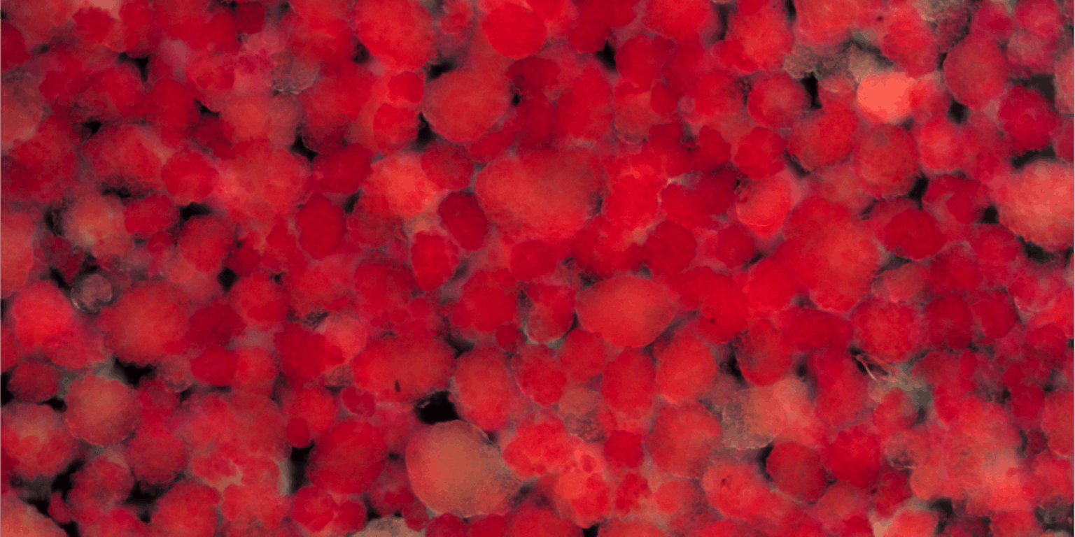 Betacellen in de Eilandjes van Langerhans (in rood) .