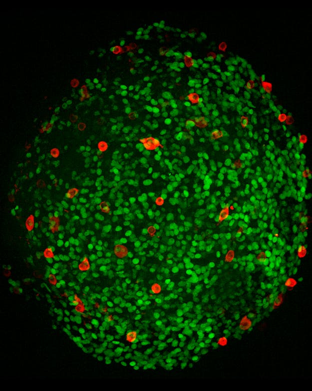 Mini-testis organoid met voorlopers van voorplantingscellen