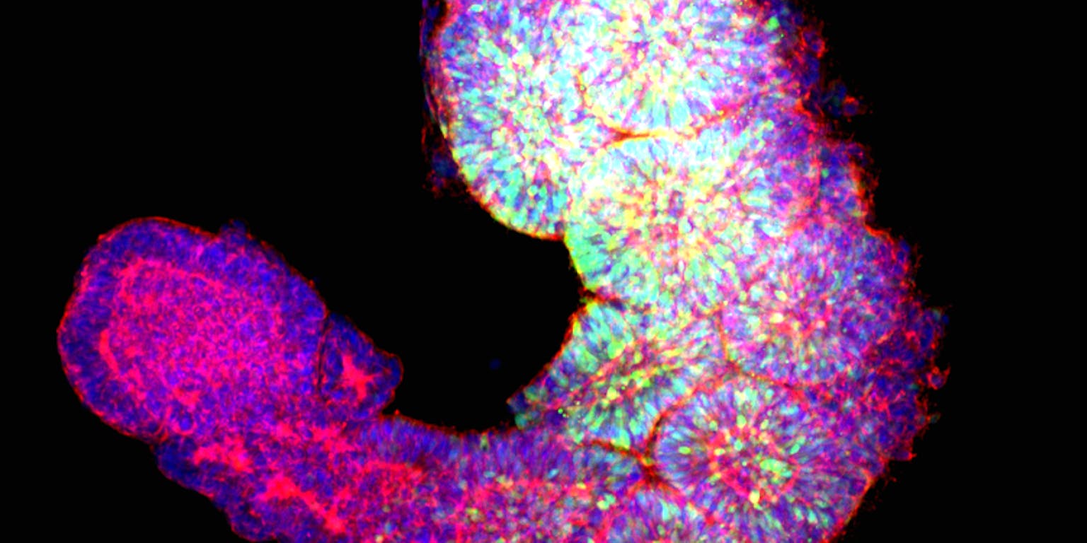 Beeld van een nagebootst deel van een vroeg menselijk embryo.