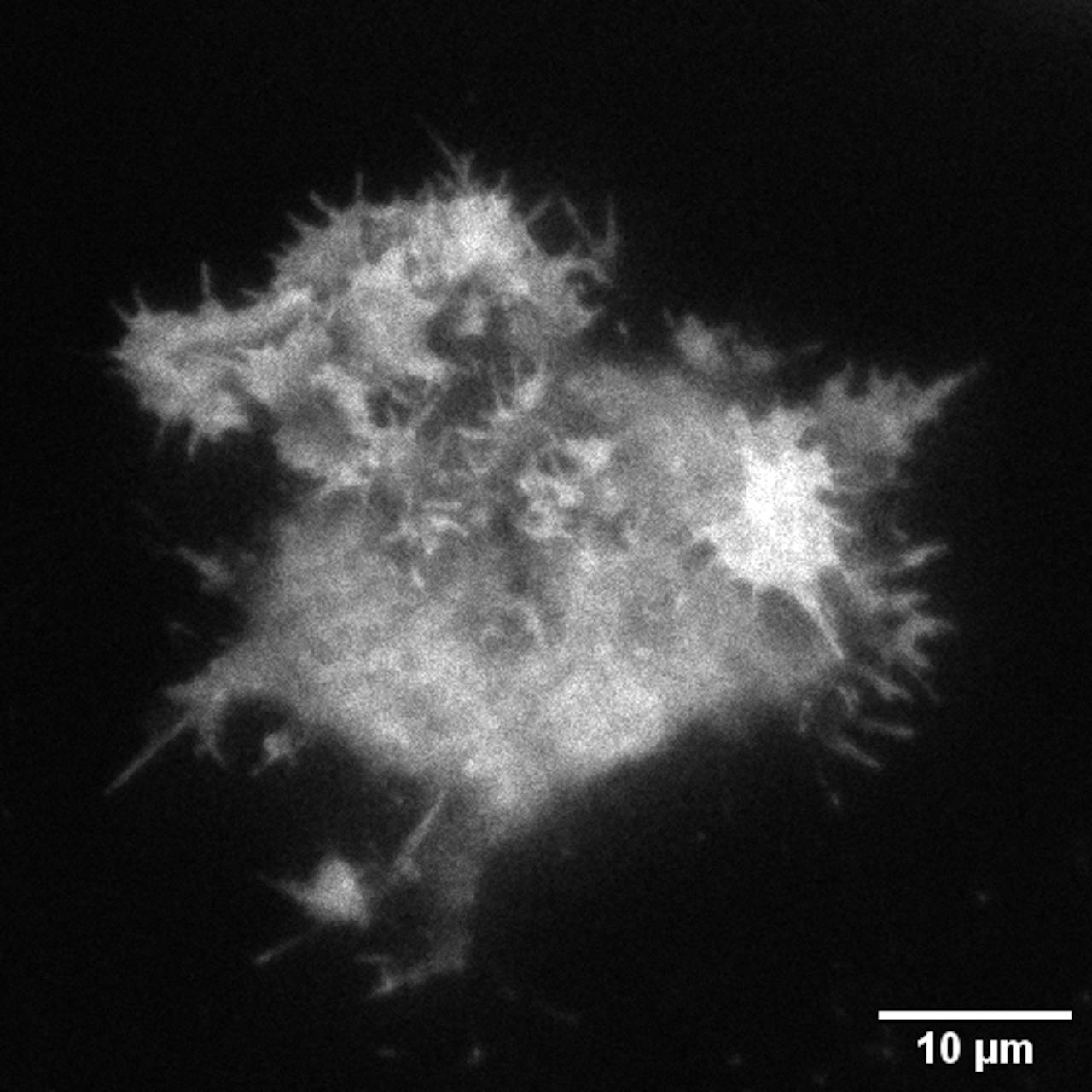Voorbeeld van een cel waarbij één soort eiwit lichtgevend is. De schaalbar geeft 10 micrometer (μm) aan. Op welk dier vind jij deze cel lijken? Laat het weten in de comments! cel met een soort lichtgevend eiwit gemaakt door Face of Science Tom Aarts